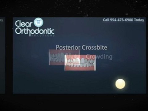 Invisalign Fort Lauderdale For You