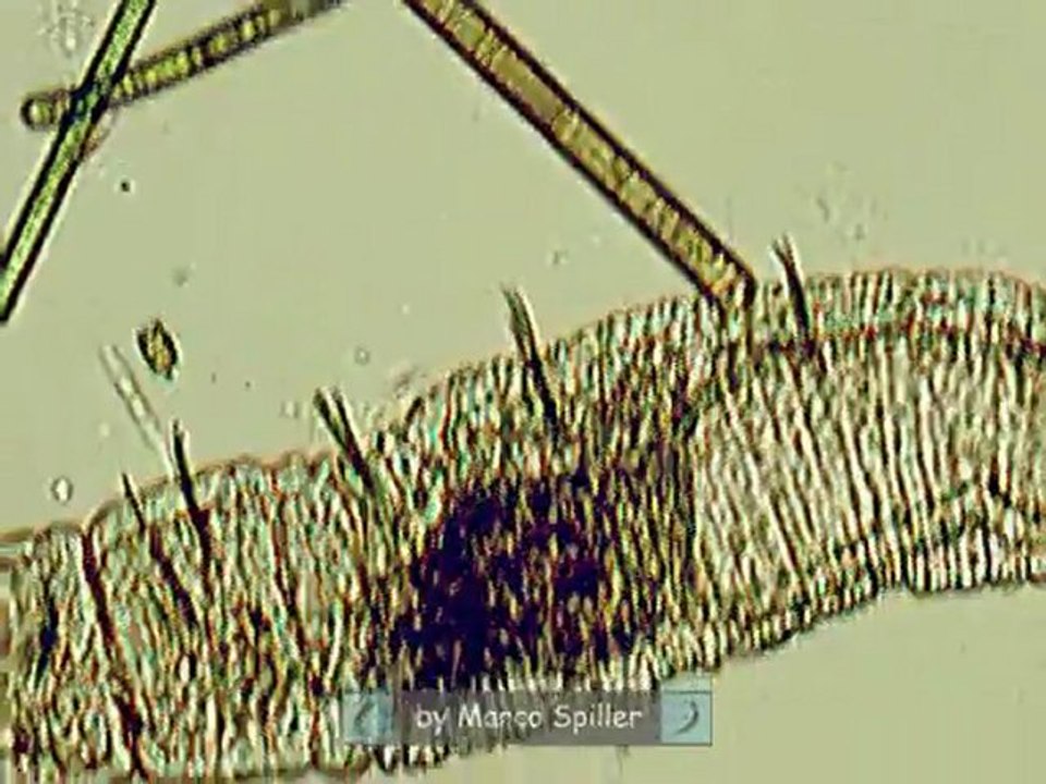 Chaetogaster