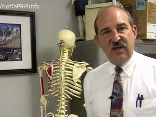 Back Pain Treatment using Platelet Rich Plasma Injections