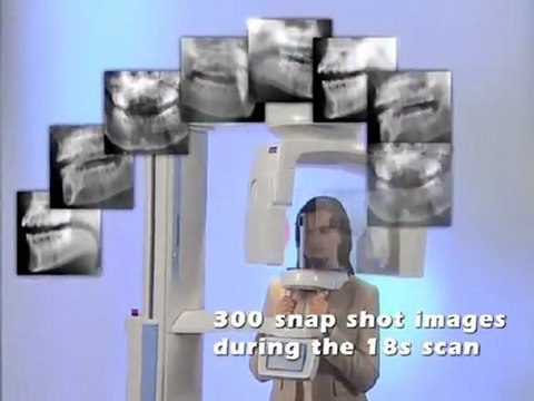 Planmeca Promax 3D tecnology