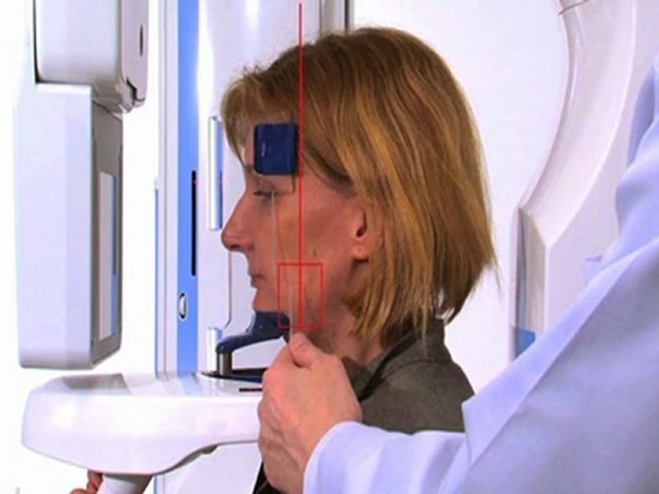 Promax 3D - Colocacion Precisa del 3r molar