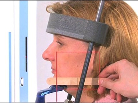 Promax 3D - Max-Una colocación más baja de los dientes Superiores