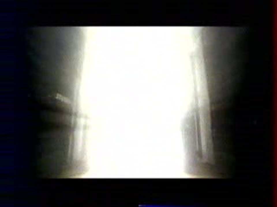 CANAL+ -  Björk Medúlla -