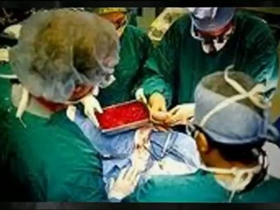 Kidney Problem