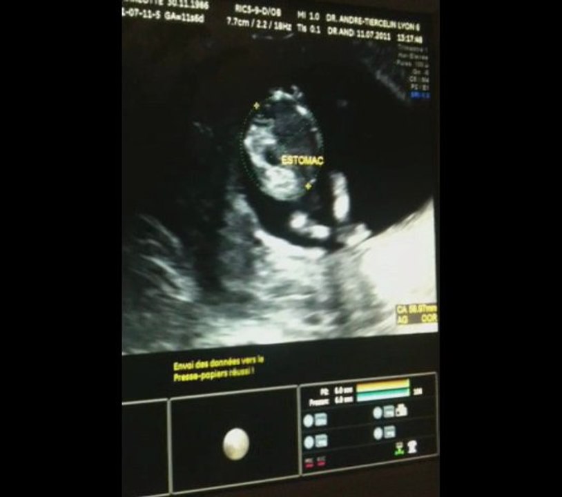 Notre deuxième rencontre le 11 juillet 2011...