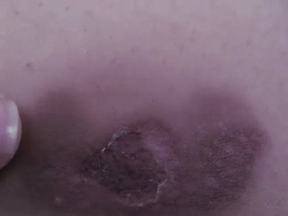 I have a weird scar...