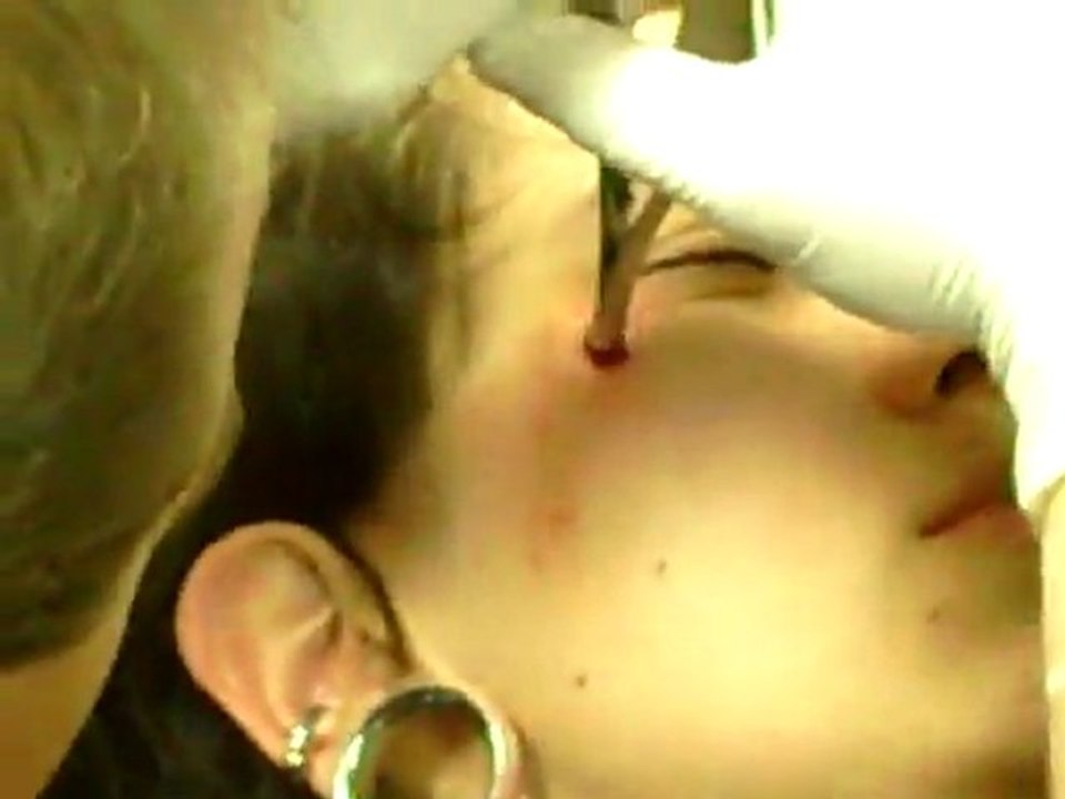 Stormi's eye dermal by Tom Hasch