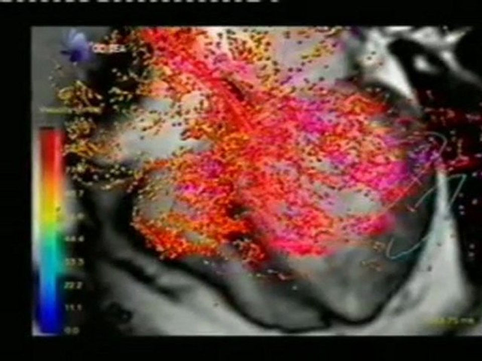 Modelo cardiaco: Corazon virtual 3D