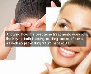 acne scars treatment