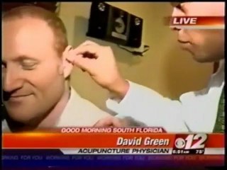 Acupuncture Boynton Beach FL