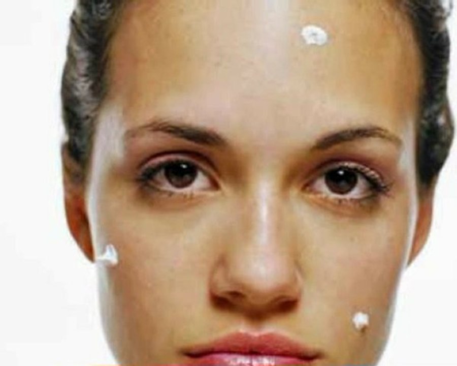 acne treatment