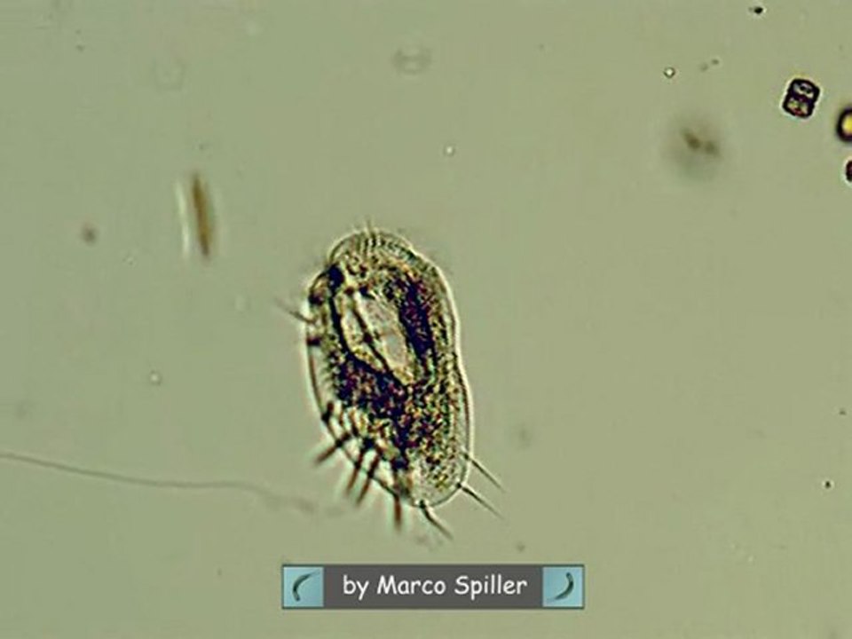 Euplotes patella