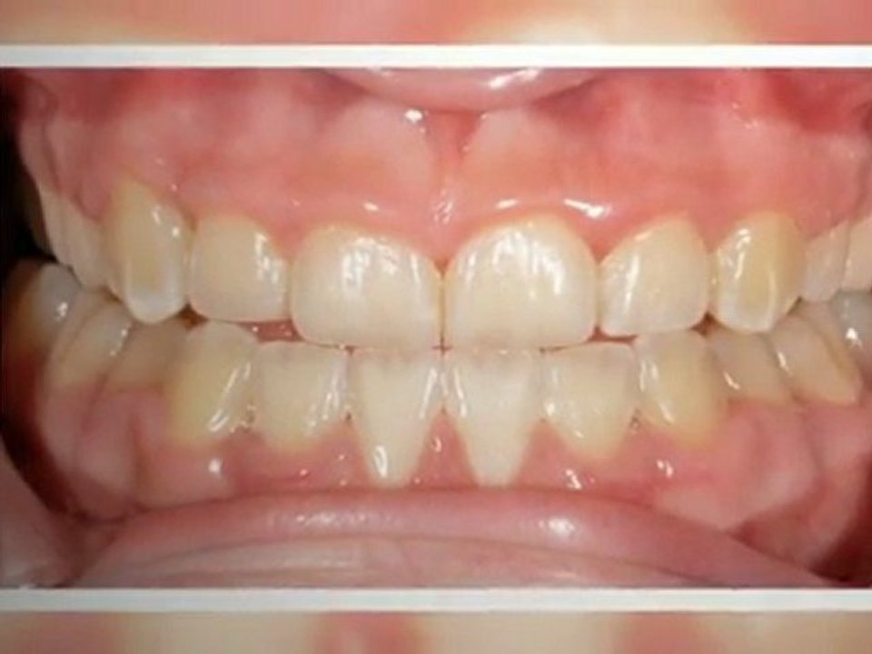 Orthodontist Parker CO - New Smiles!