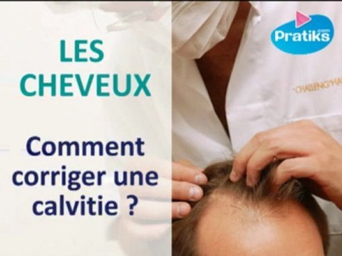 Les cheveux – Comment corriger une calvitie ?