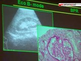 TG 06.11.10 Nuove frontiere dell'ecogorafia, in urologia e nefrologia