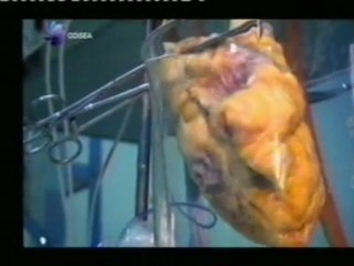 Celulas madre: Construir un corazon