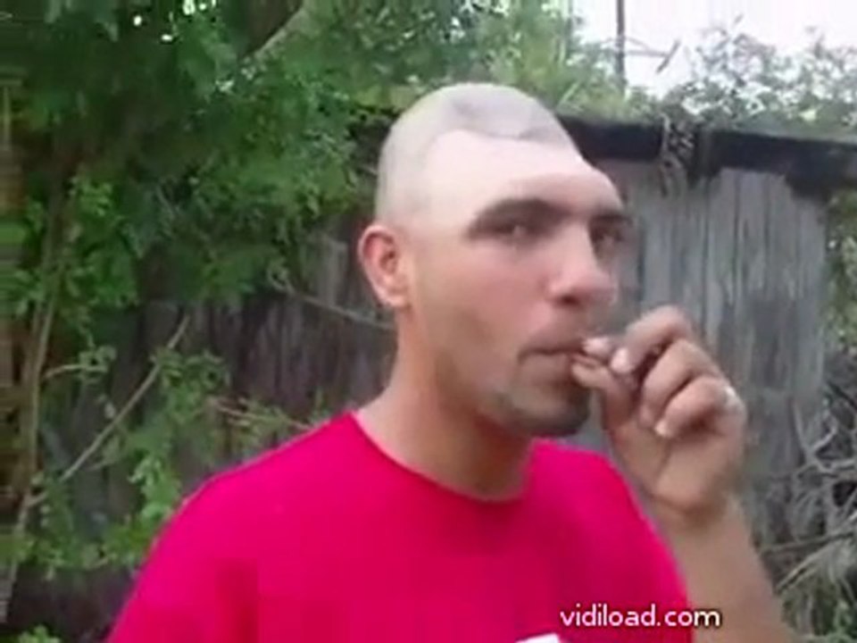 Guy Living With Half A Schädel