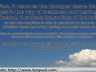 Fungusil Brings Grade A Tools to the Table to Treat Nail Fun