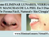 como quitar verrugas de la cara - como quitar lunares de carne - verrugas en la cara