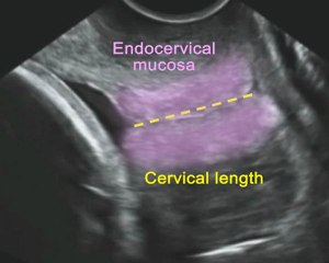 FMF Courses- Cervical assessment