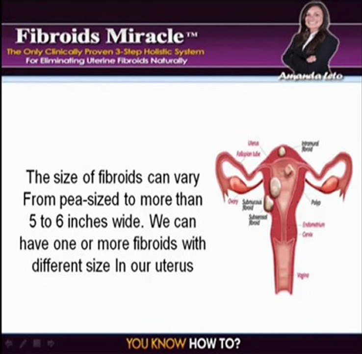 uterine fibroids symptoms