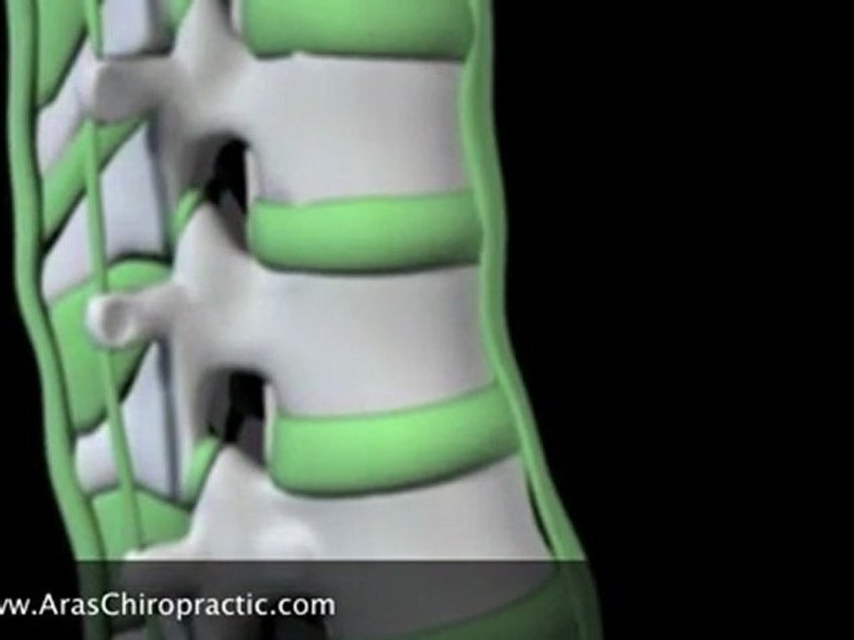 Singapore-What Is Chiropractic