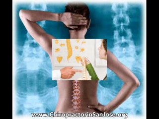 Chiropractor in San Jose Tips