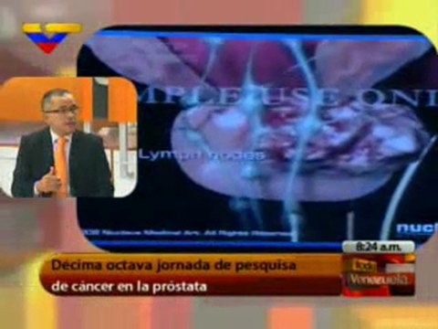 JORNADA DE DESPISTAJE DE CANCER DE PROSTATA REALIZARA HOSPITAL DOMINGO LUCIANI ESTE SABADO