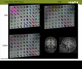 A video tutorial on crossing fibres by Prof. Daniel Alexander
