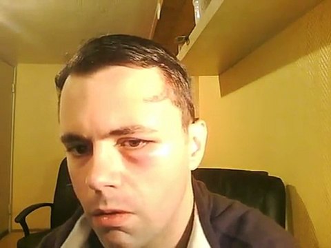 PART 62 - ASSASSINATION ATTEMPT OR ACCIDENT ONLY !!? GOVERNMENTS HAVE NOT ONLY DENIED EMPLOYMENT FOR ALREADY SEVERAL YEARS, BUT ALSO THE RIGHT TO HOSPITAL HELP IN CASE OF NEED(Swedish hospital refused help).