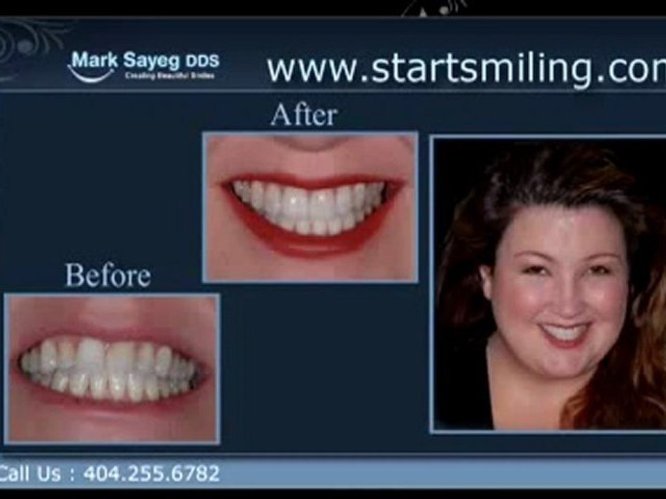 Cosmetic Dentistry Atlanta - Mark Sayeg DDS