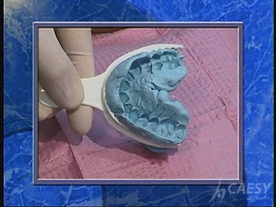 OVDE Lower Jaw Procedure