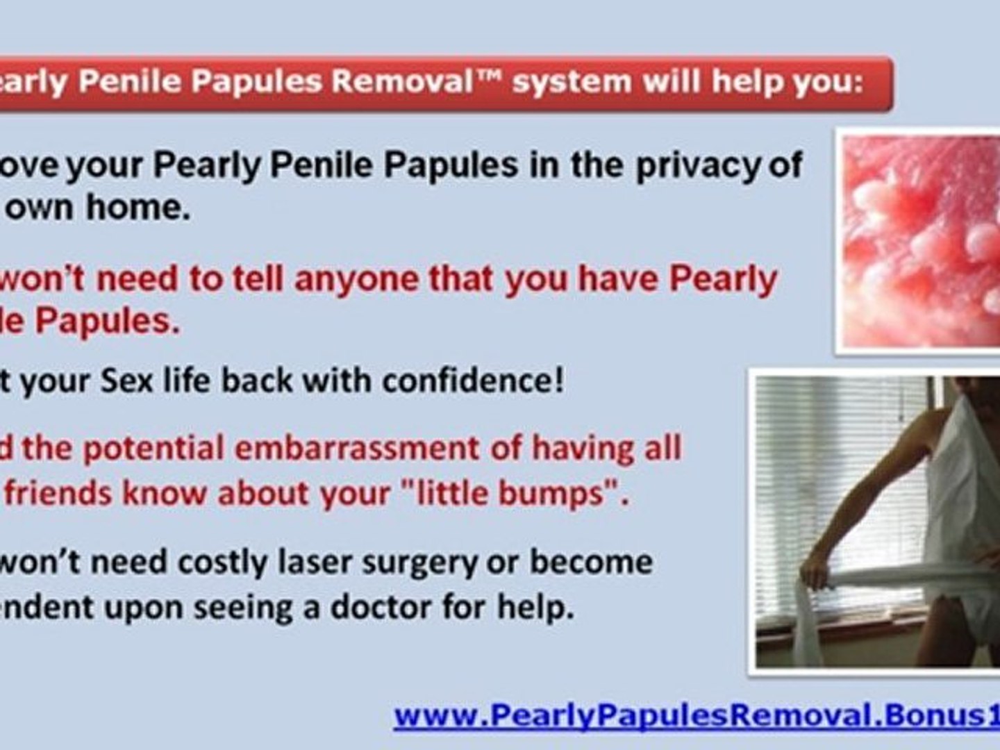 Do papules appear pearly penile why 3P Gel