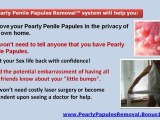 pearly penile papules removal - penile papules treatment - penile papules removal