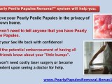pearly penile papules treatment - penile pearly papules - how to get rid of pearly penile papules