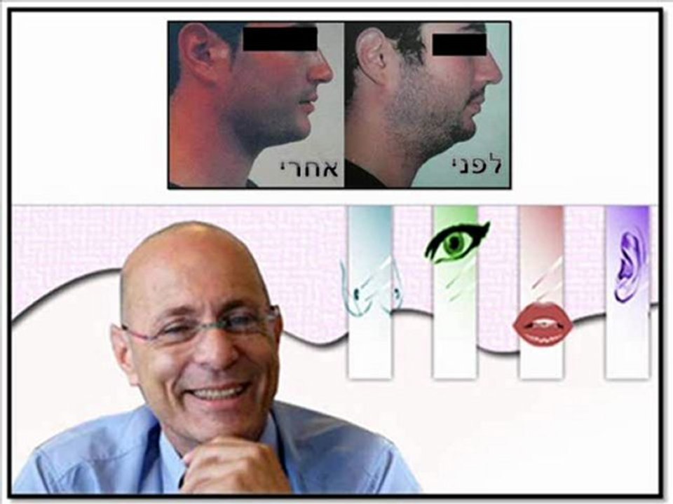 כיצד ניתן להסיר סנטר כפול בקרב צעירים