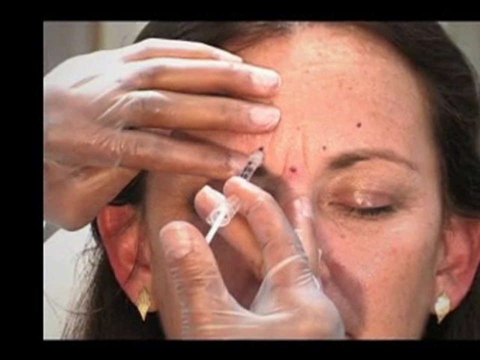 botox in philadelphia