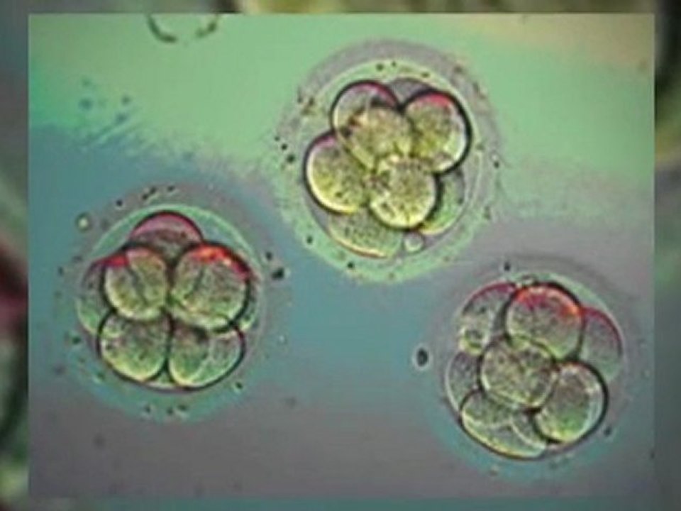 Infertility Specialist Scottsdale puts in plain words in vitro fertlization (IVF) Process