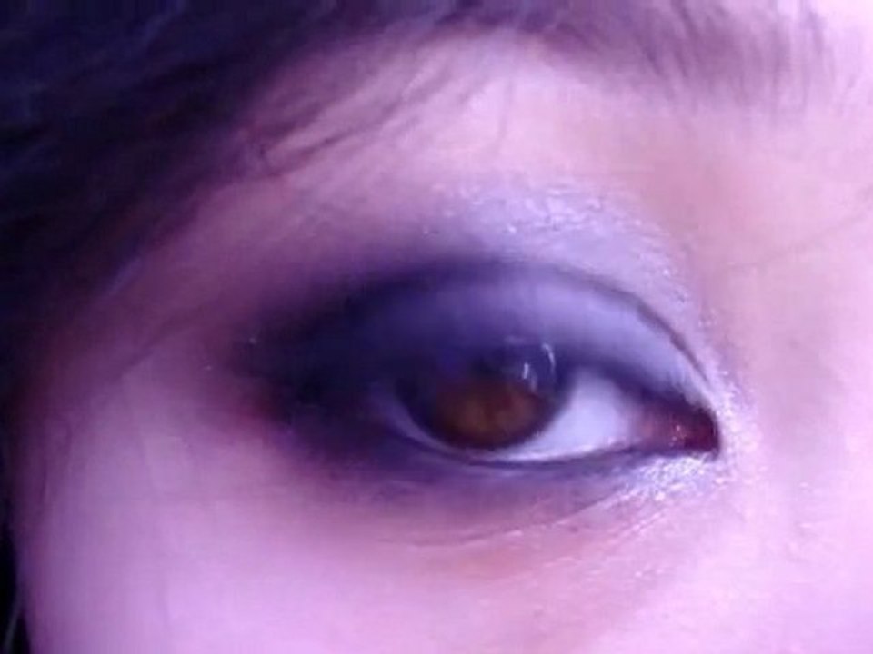 Heterochromia
