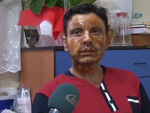 eyüp Zabıta memuruna -uçan balonlu- saldırı -ciftepinar.net..siddetle kınıyoruz