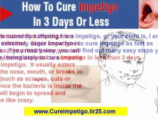impetigo treatment - remedies for impetigo - how do you cure impetigo