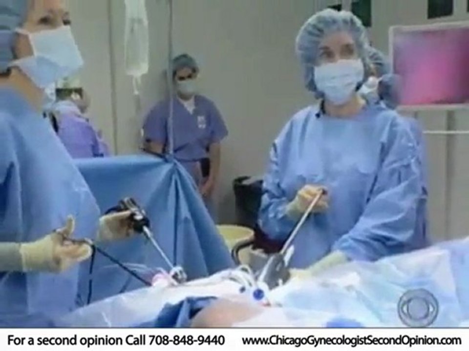 Hysterectomy Chicago Surgeon - laparoscopic ...