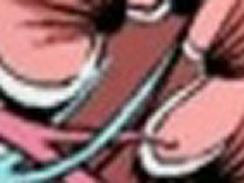 Information On Kidney Disease Symptoms