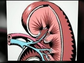 Information On Polycystic Kidney Disease