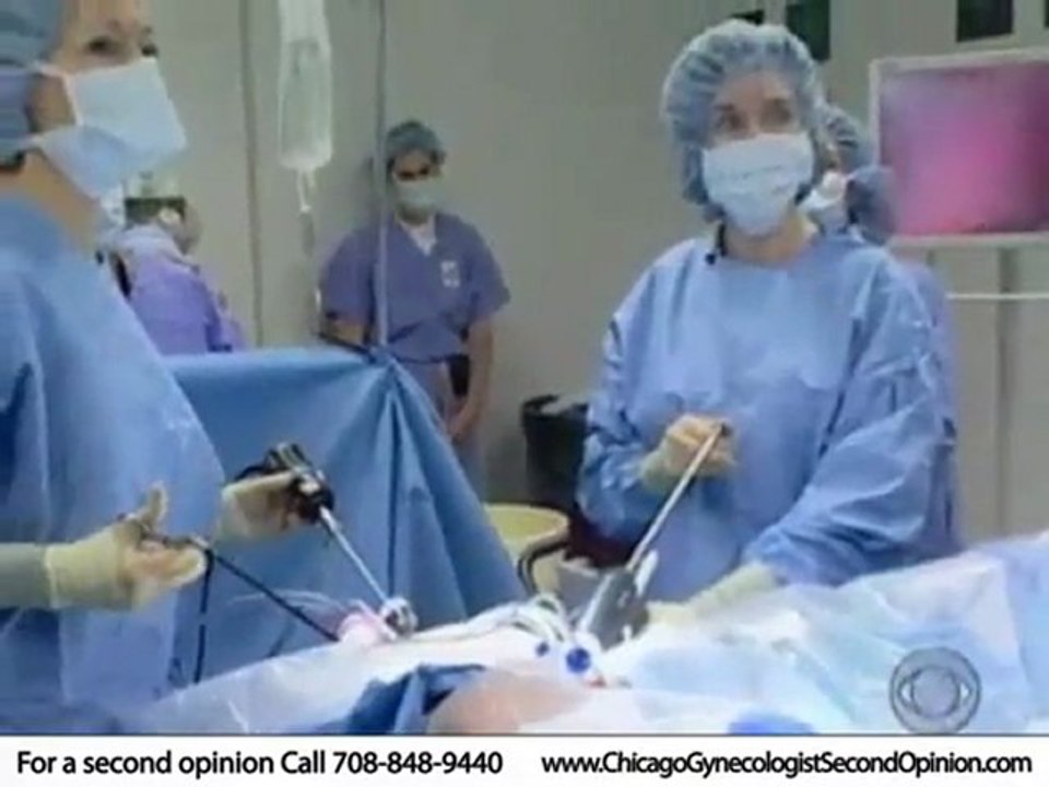 Hysterectomy Chicago Surgeon - laparoscopic ...