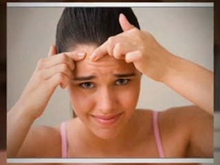 Treat Acne Naturally - Get Rid Of Acne