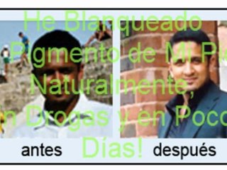 como tener piel mas blanca