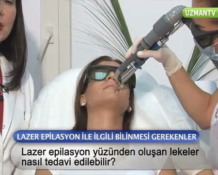 Lazer epilasyon yüzünden oluşan lekeler nasıl tedavi edilebilir ?
