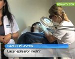 Lazer epilasyon nedir ?