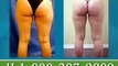 Tampa Thigh Liposuction - Leg & Knee Lipo in Tampa Bay